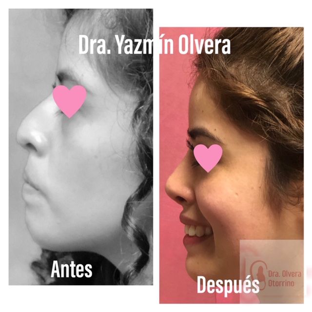 Ma. Yazmín Olvera Suárez-79