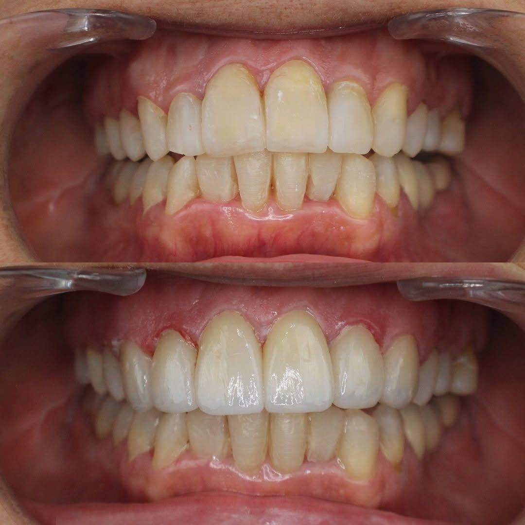 Alejandro Bates Souza-4