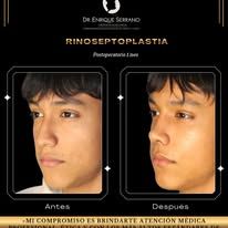 Enrique Serrano Cruz-6