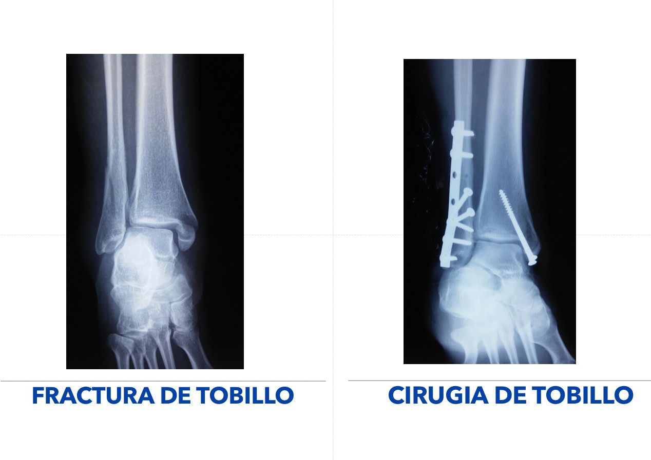 Pablo Mendoza Becerril-5