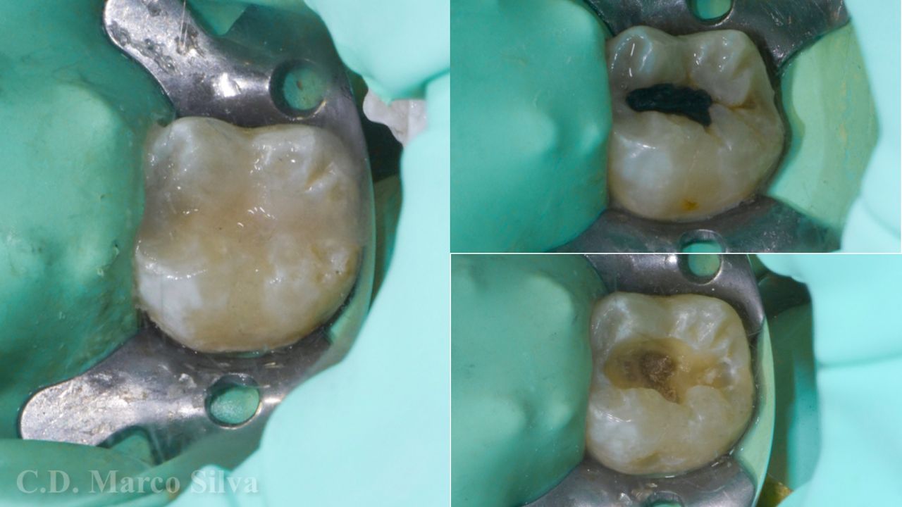 Marco Antonio Silva-17