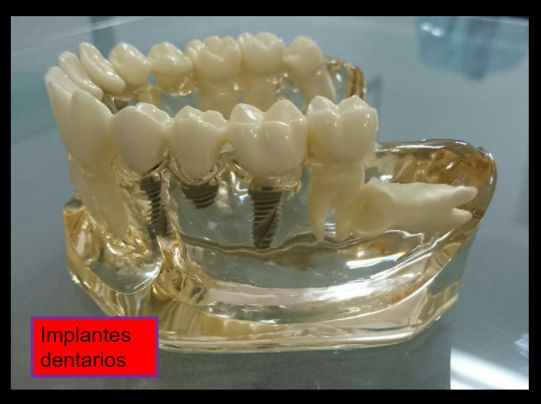 Diana Araceli Dávila Hernández-37