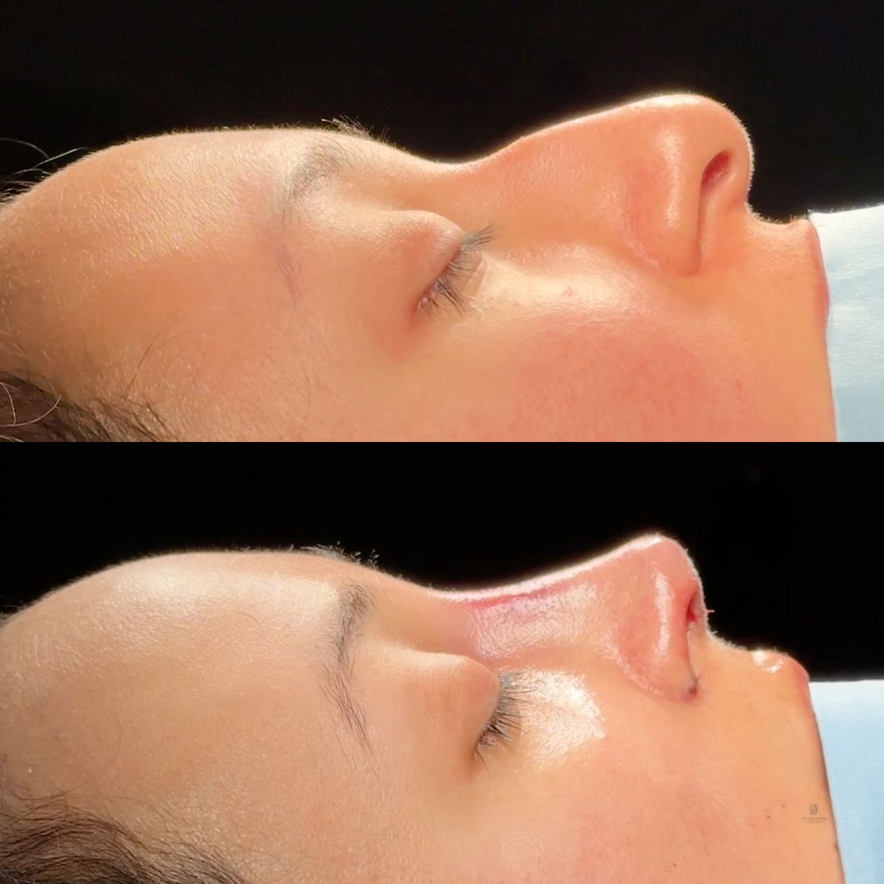 Angel Castro Urquizo-226