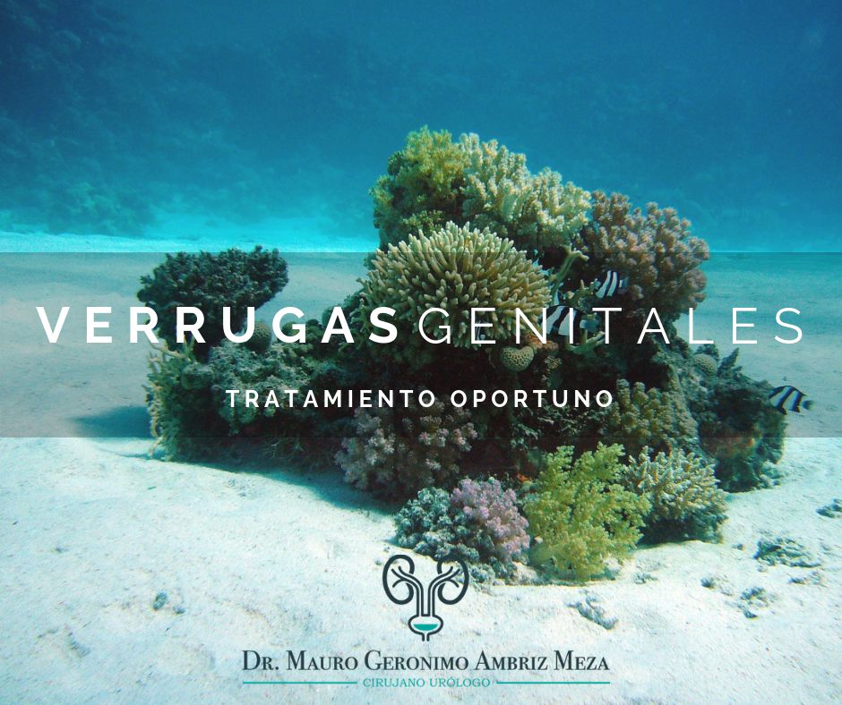 Mauro Geronimo Ambriz Meza-4