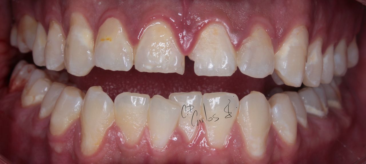 Carlos Enrique Hernández Rodríguez-35