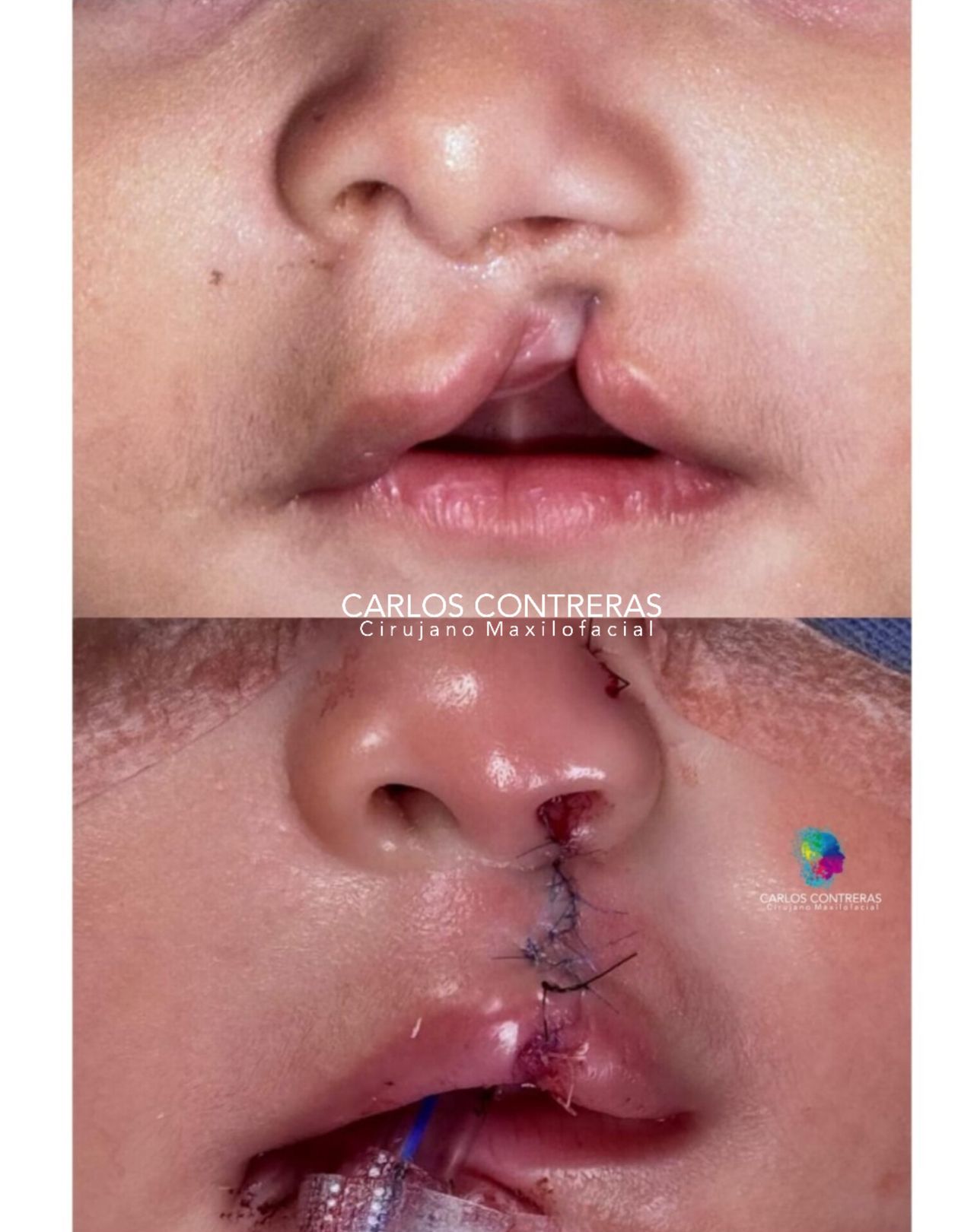 Carlos Ernesto Contreras Castellanos-41