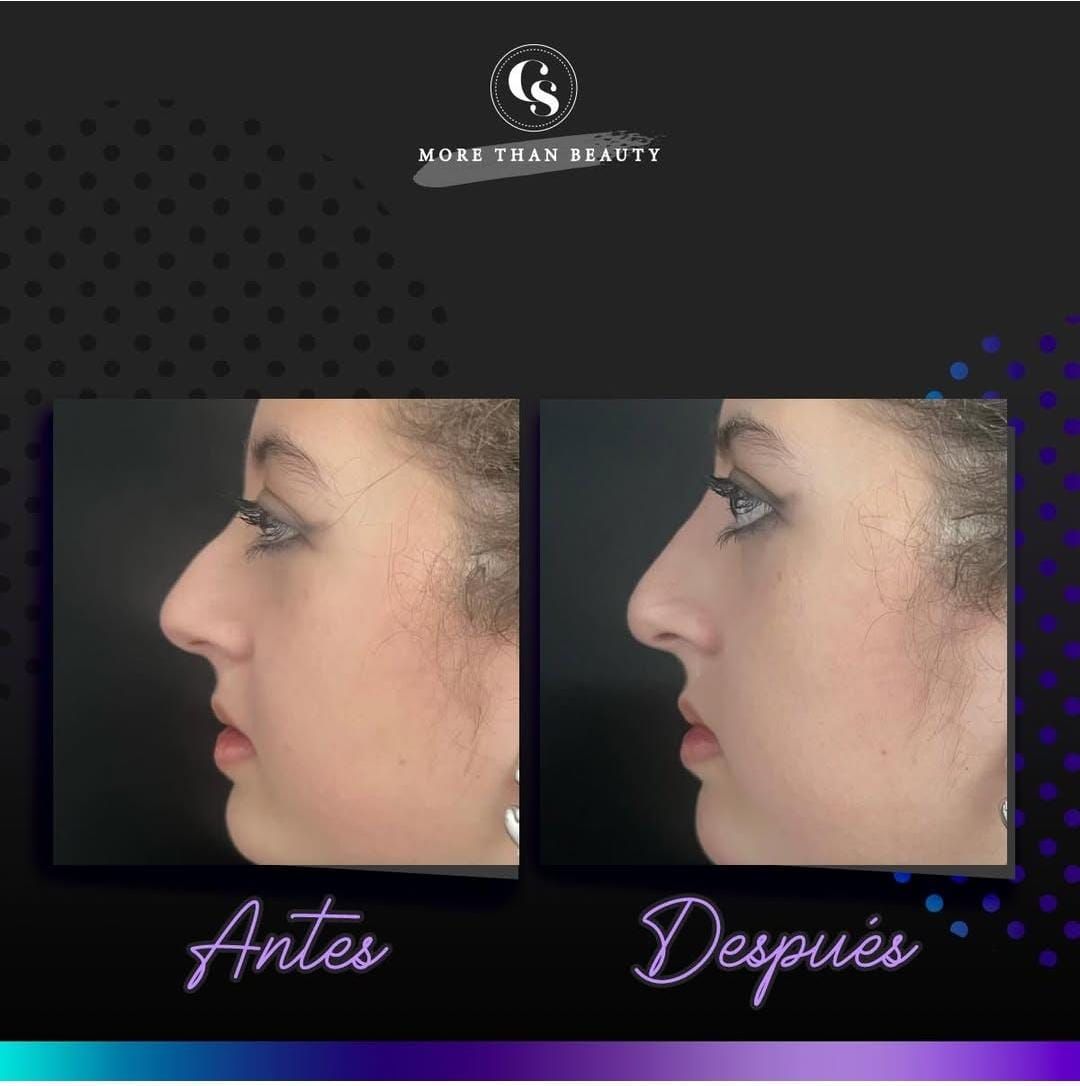 Diana Hannah Carreon-12