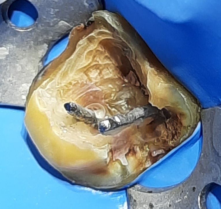 Oscar Justo Bustos-6