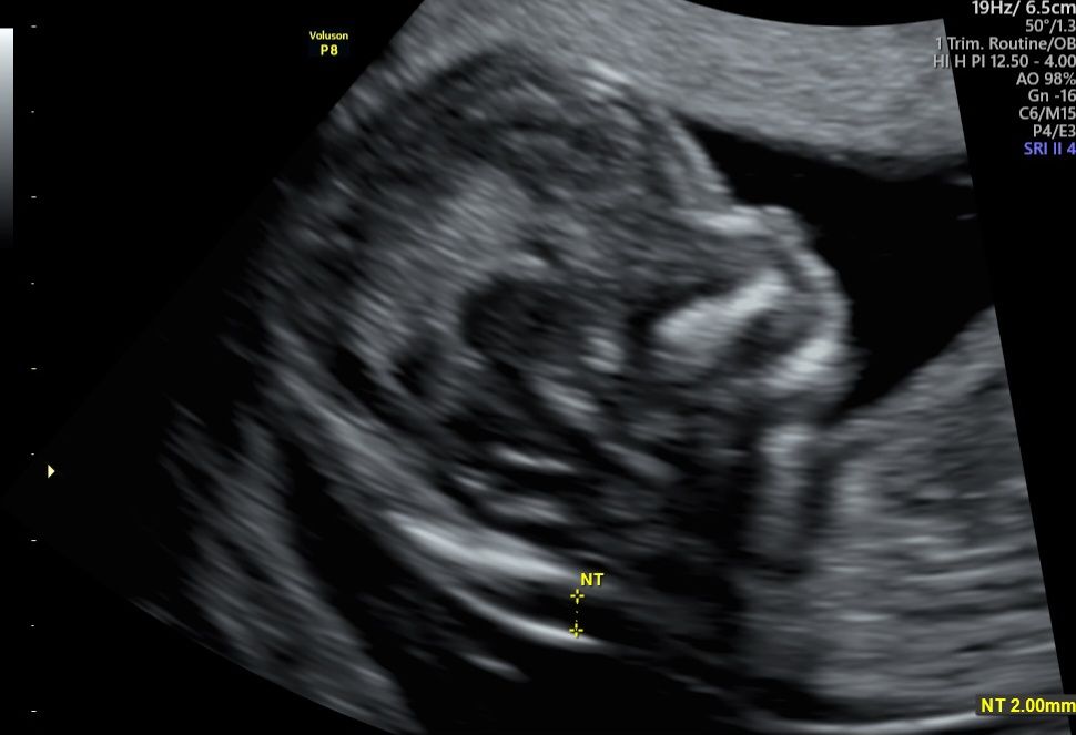 Rubí Tobón Delgado-2