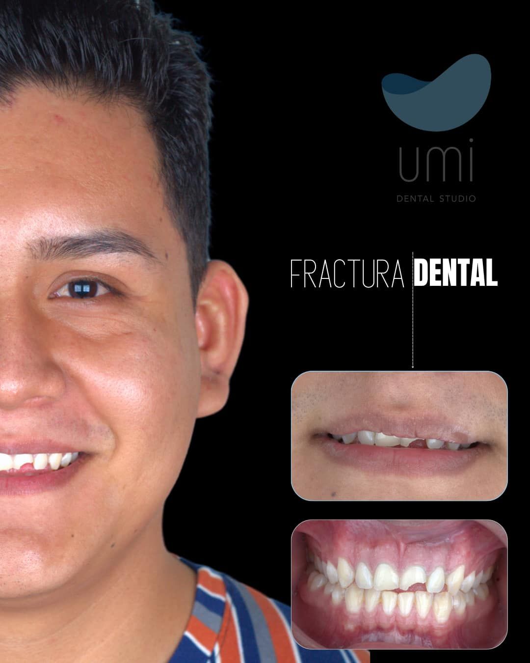 Anahí Bahena Sosa-1