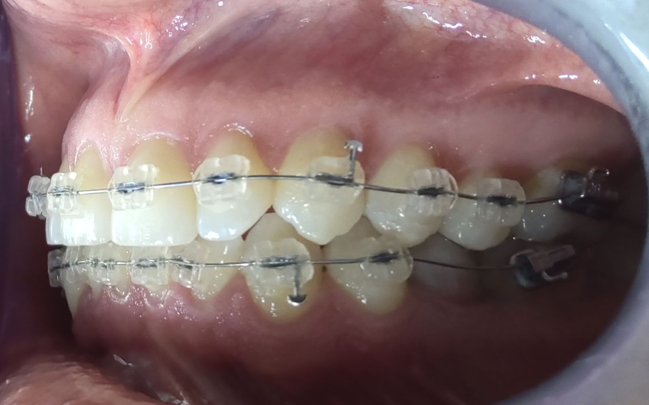 Jair Contreras García-8