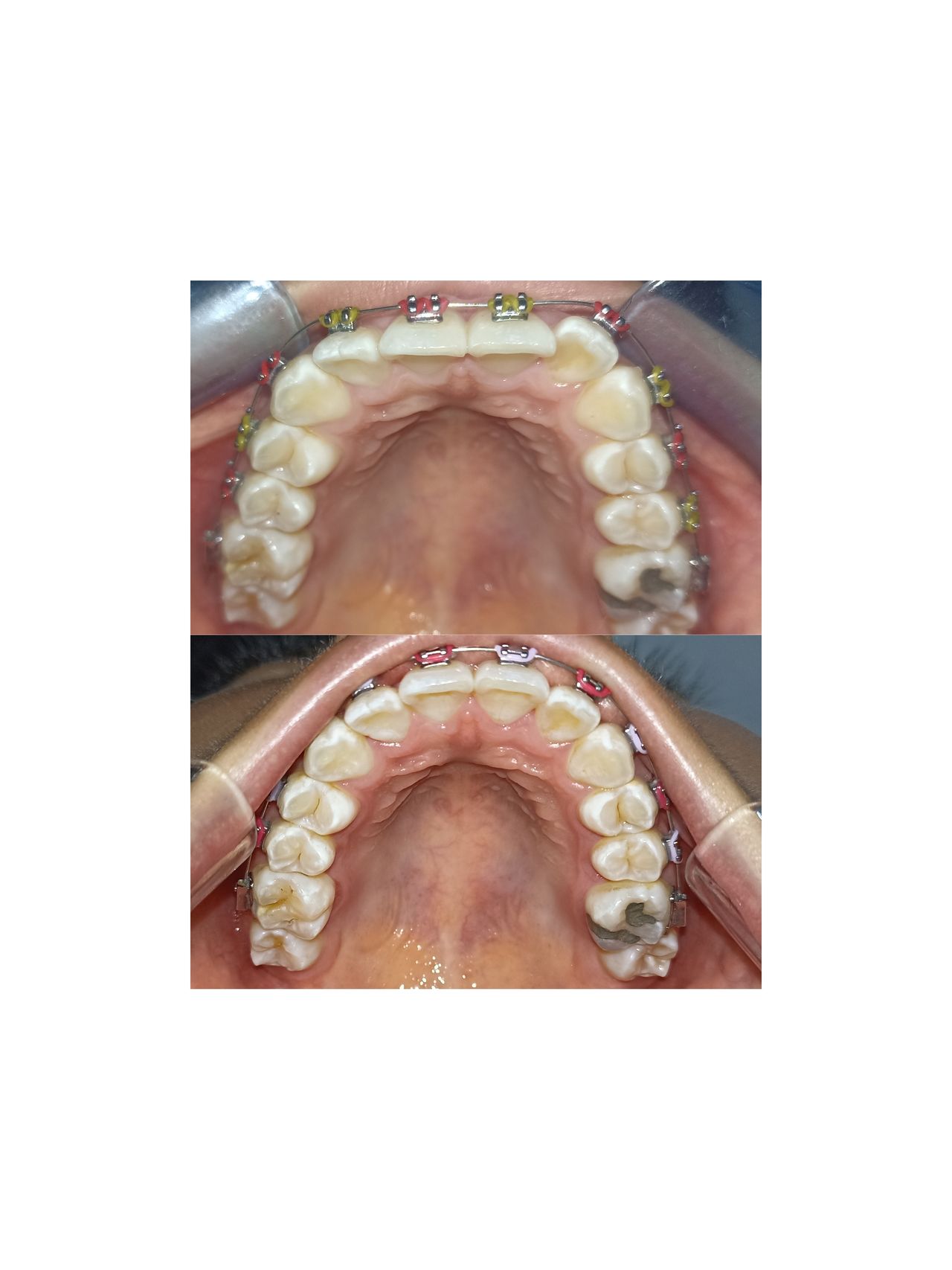 Jair Contreras García-22