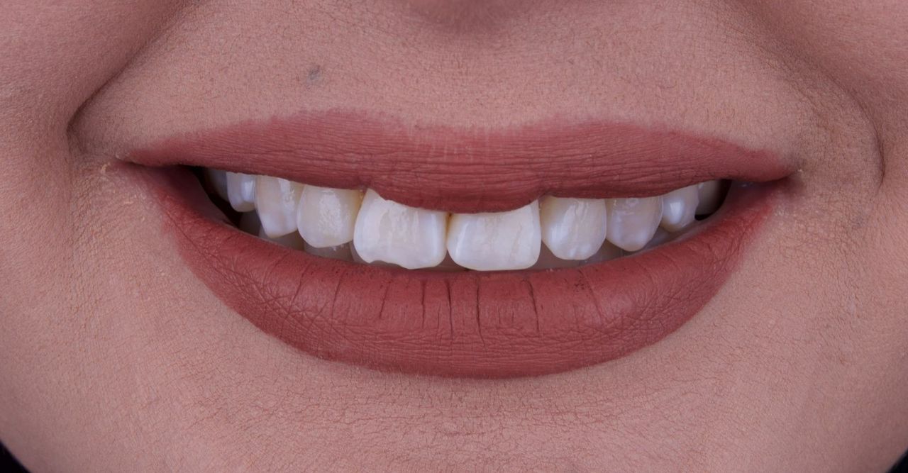 Jesús Israel López Casas-7