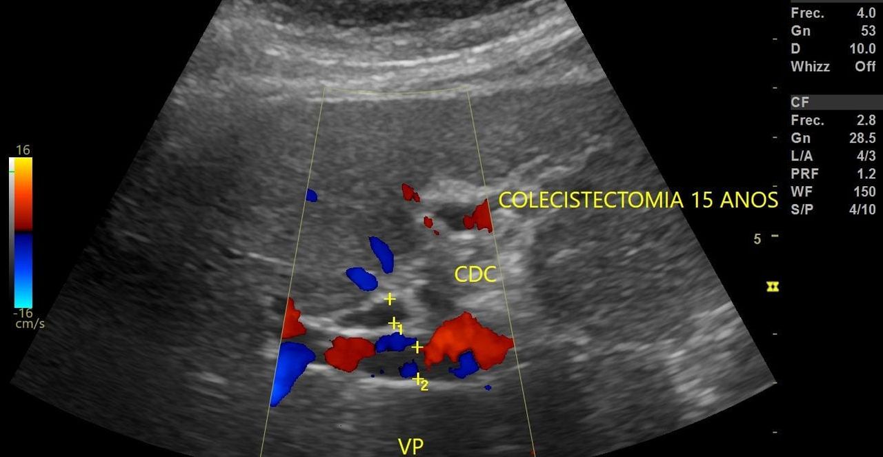 Montserrat Olvera Juárez-7