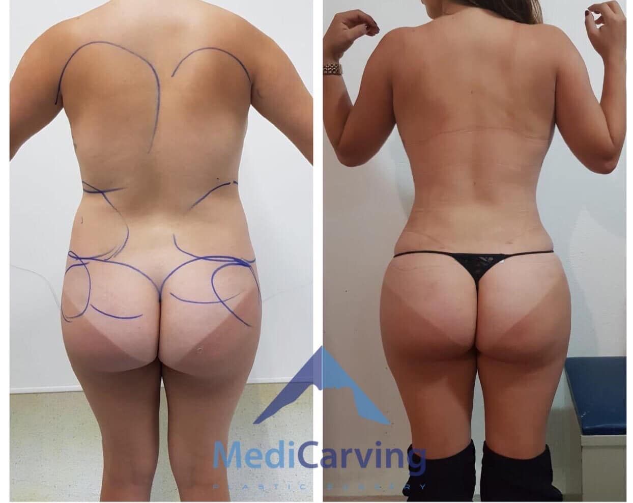 Rafael Velázquez Razo-3