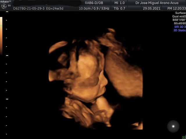 José Miguel Arano Acua-18