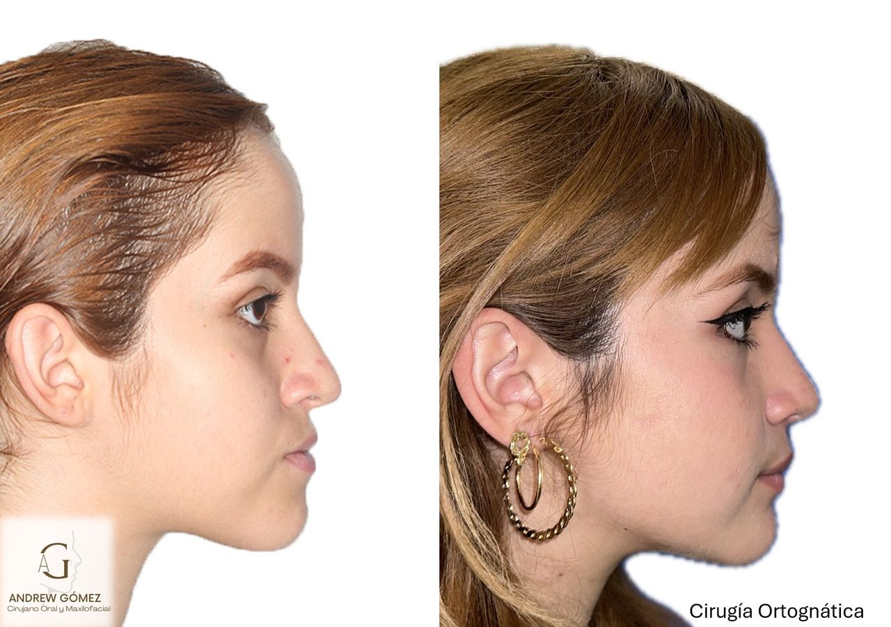 Kevin Andrew Gómez Hernández-15