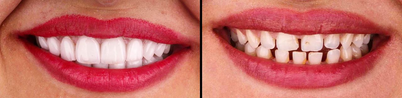 Héctor Adrián Garza Lazarini-18