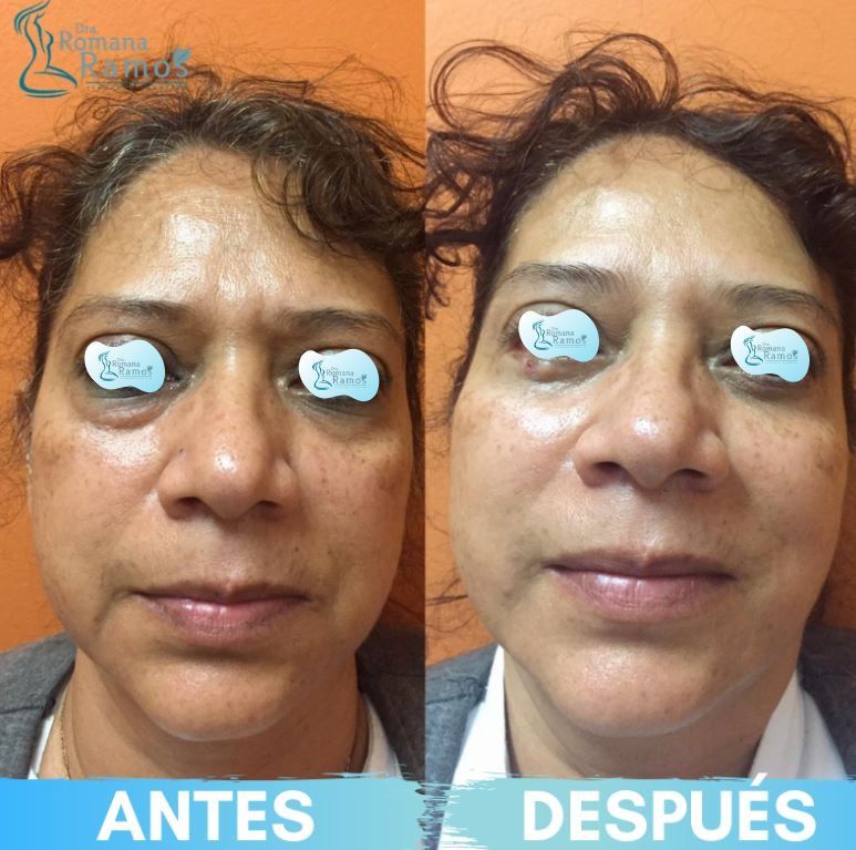 Romana Ramos Cárdenas-49