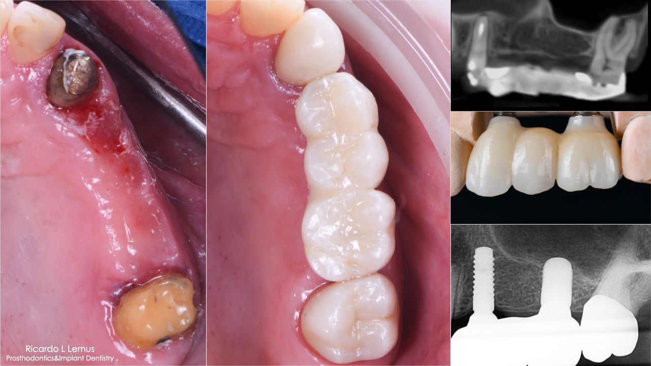 Ricardo López Lemus-109