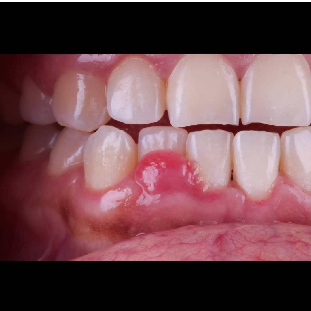 Hugo Enrique Aguilar Lamas-106