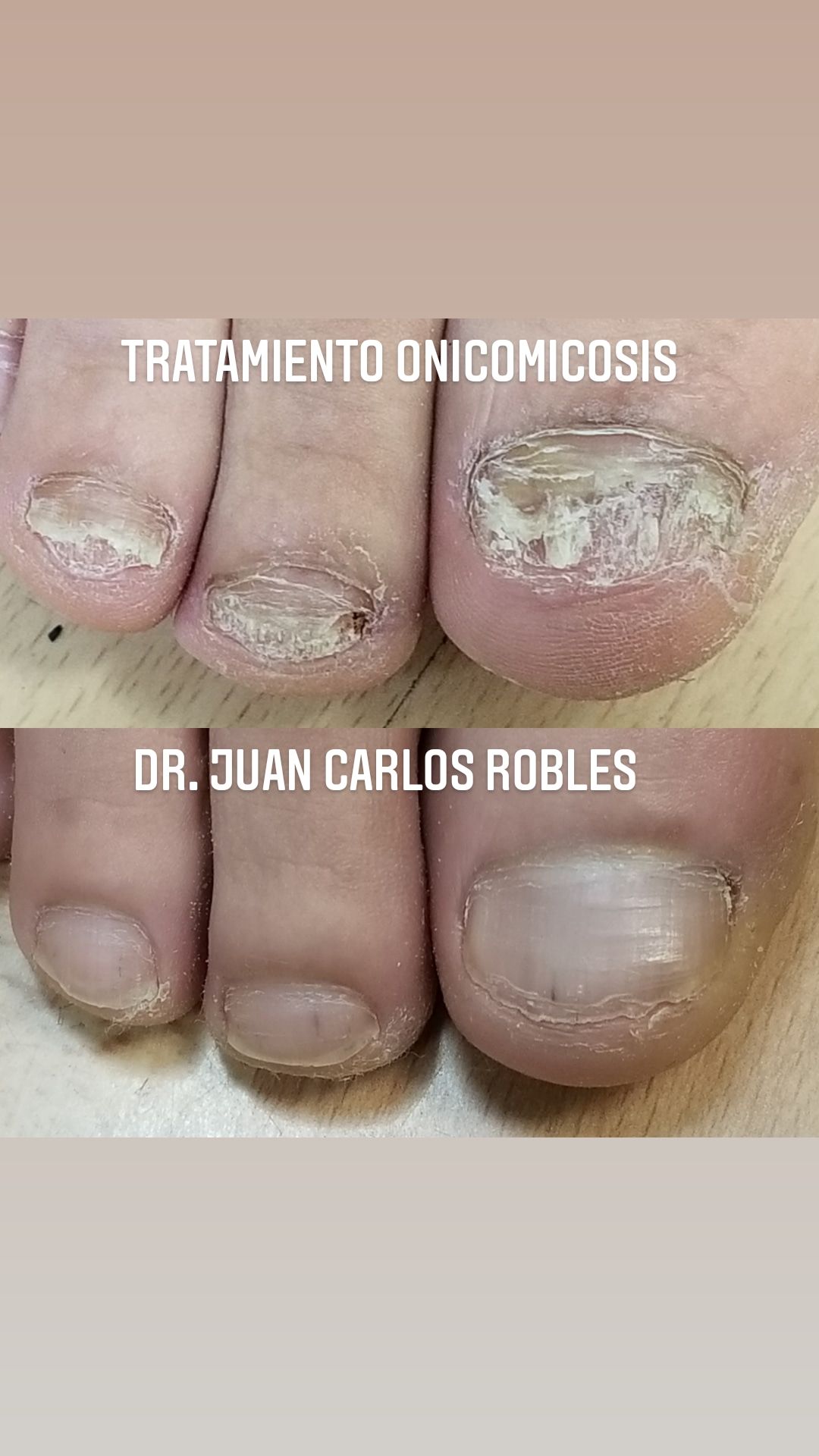 Juan Carlos Robles Méndez-27