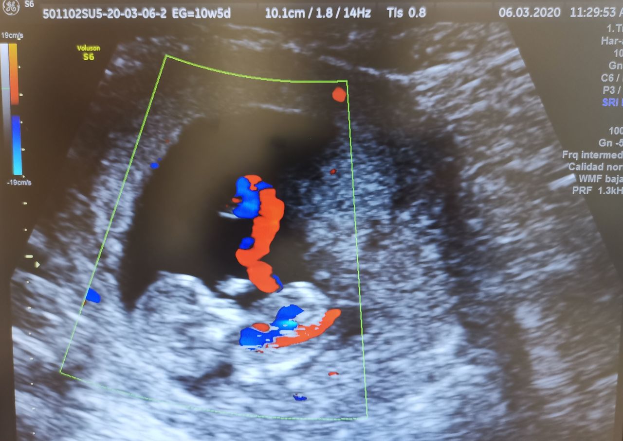 Francisco Alberto Perez Que-16