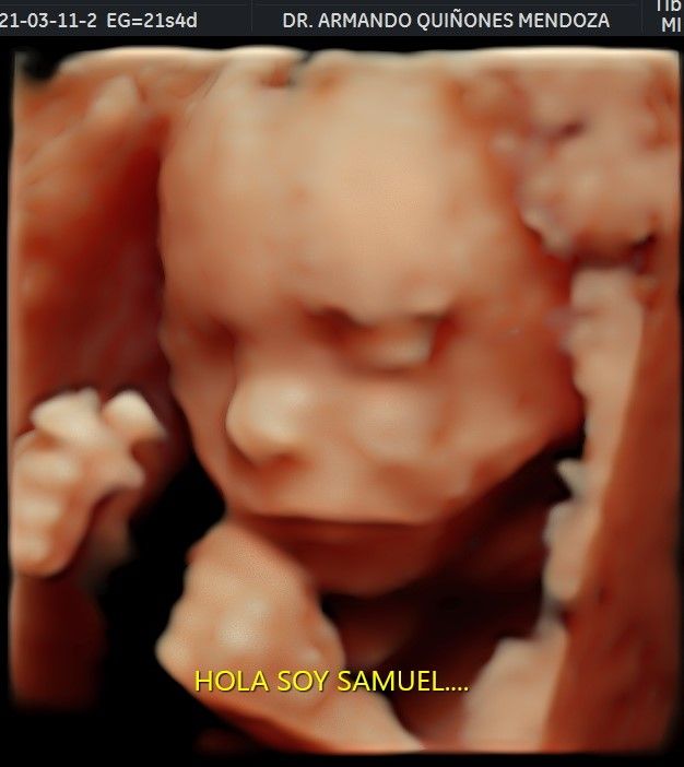 Armando Quiñones Mendoza-5