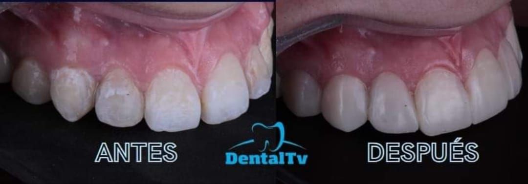 Teresa Virginia De Los Santos Falcón-0