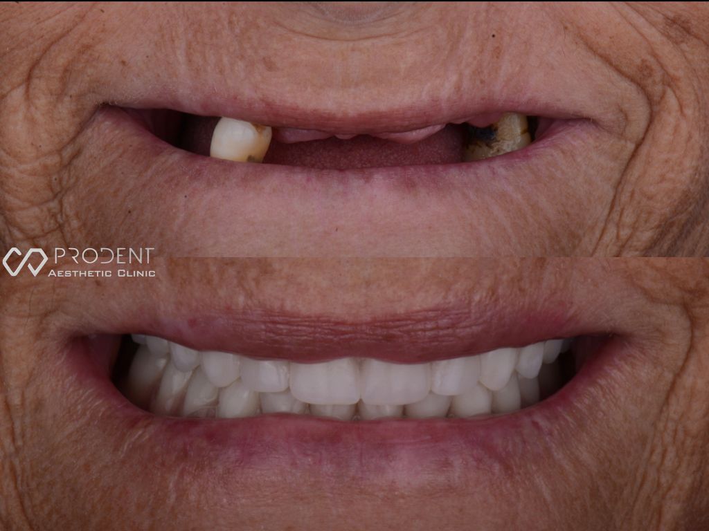 Ramiro Ivan Pérez Murillo-24