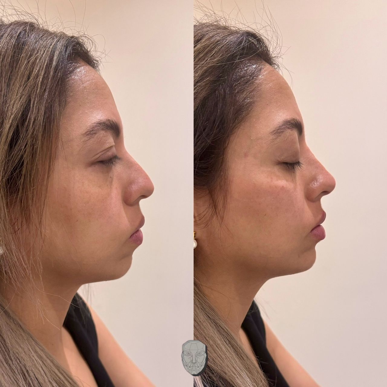 Anuar Hernández Flores-6