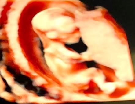 Fabiola Brito Sandoval-1