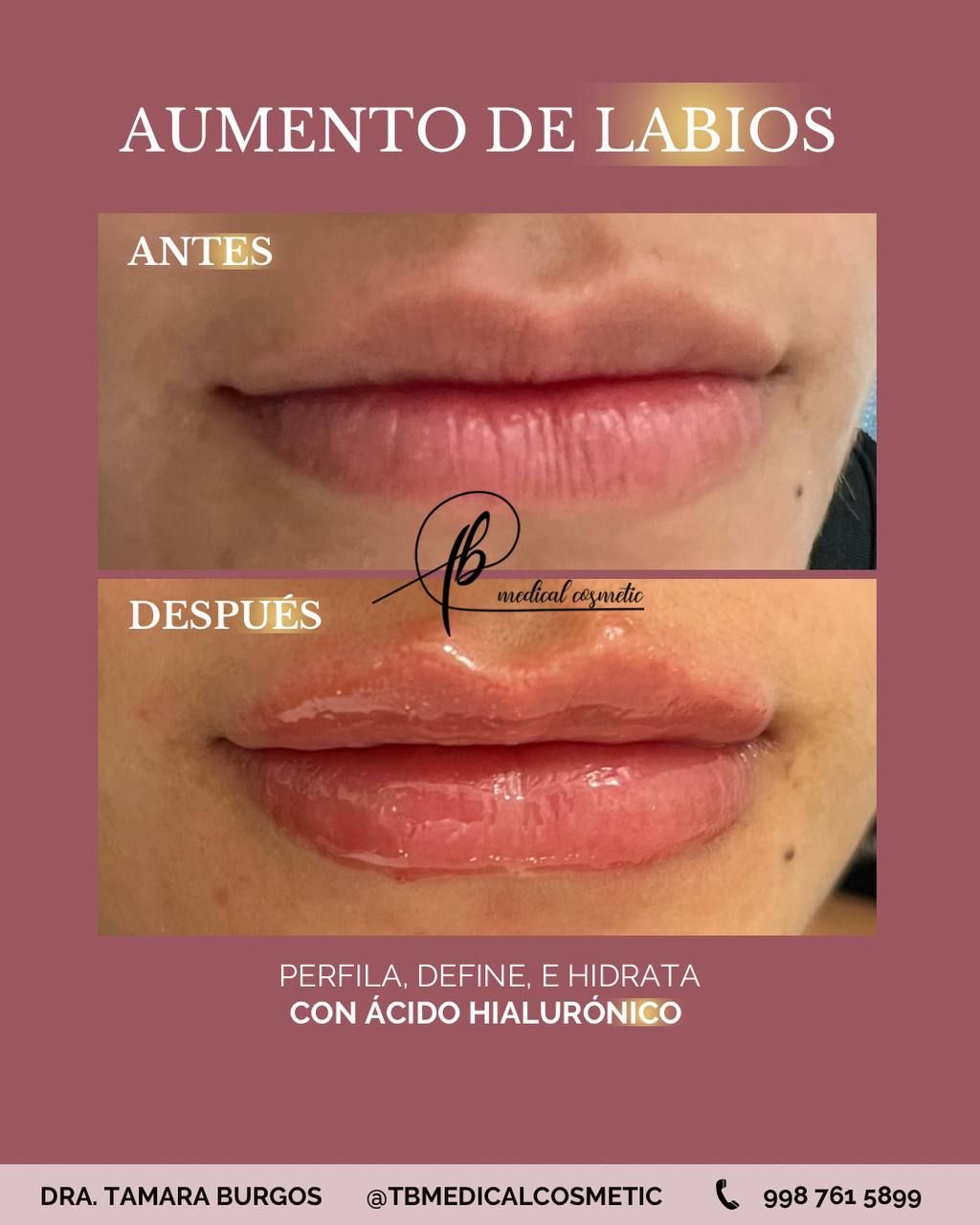 Tamara Milagros Burgos Fonseca-5