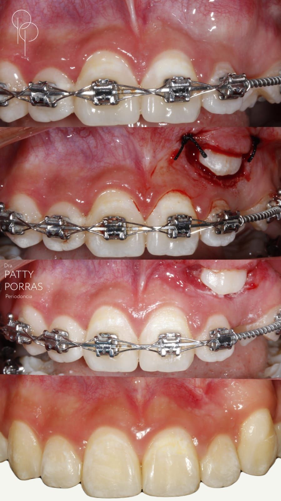 Patricia Porras Domínguez-6