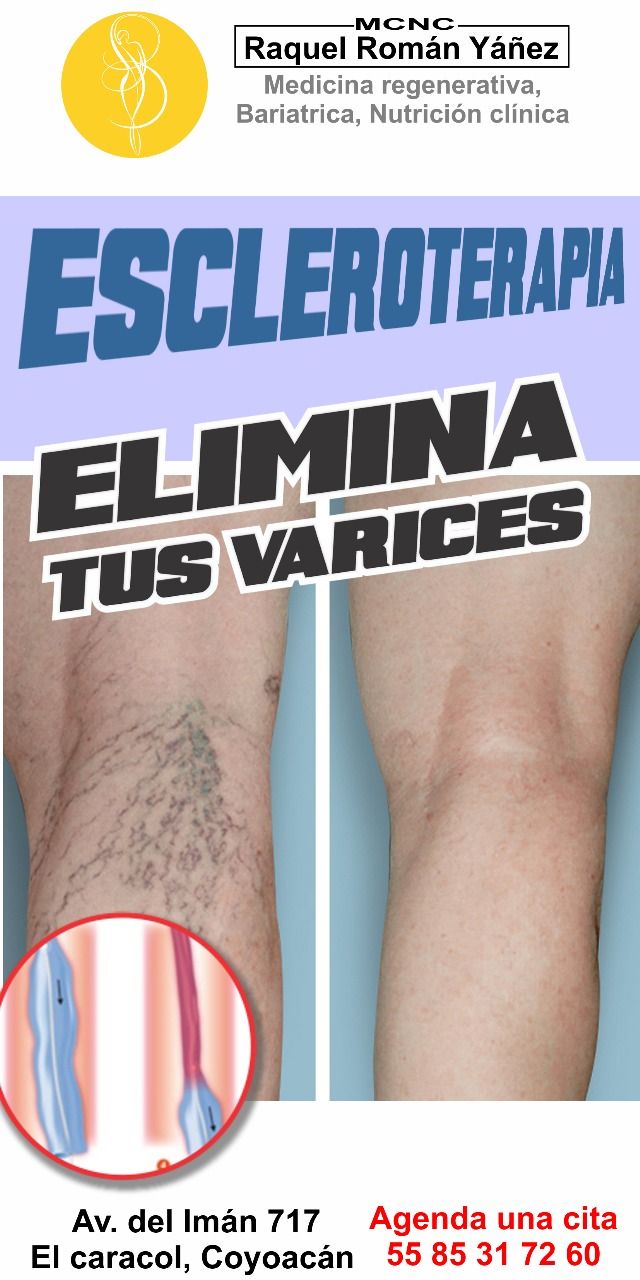 Raquel Román Yáñez-4