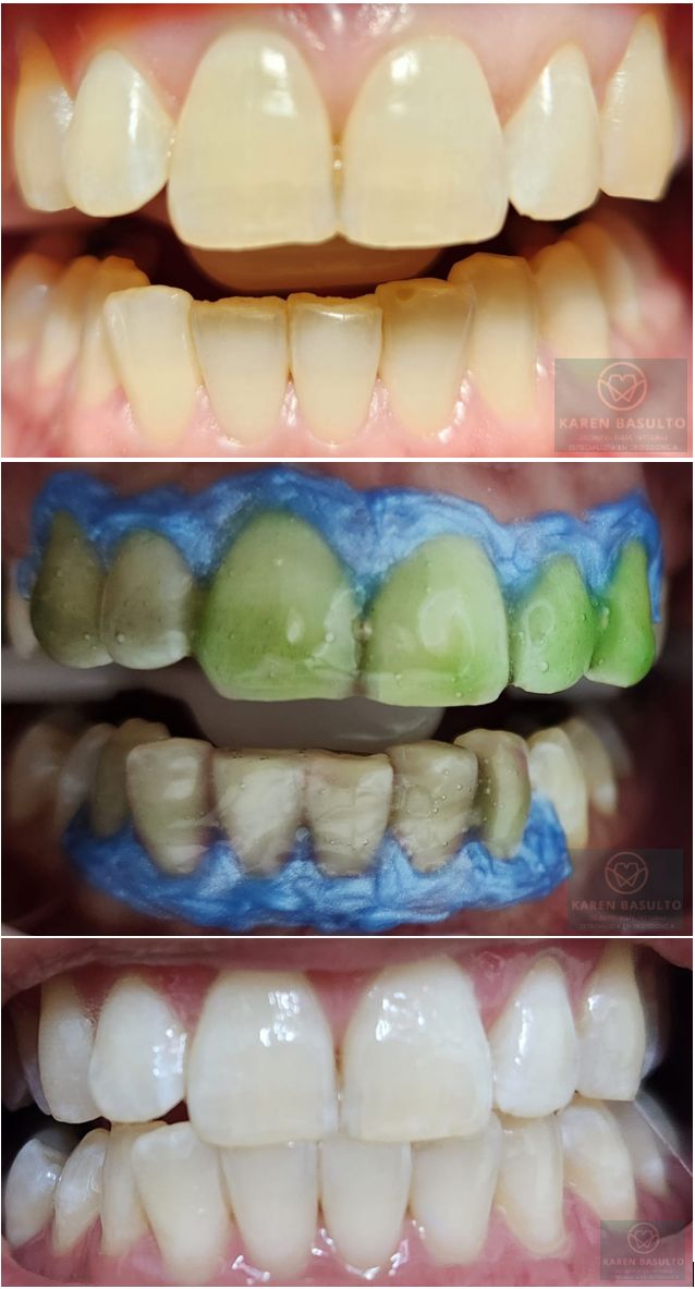 Ana Karen Basulto Cruz-3