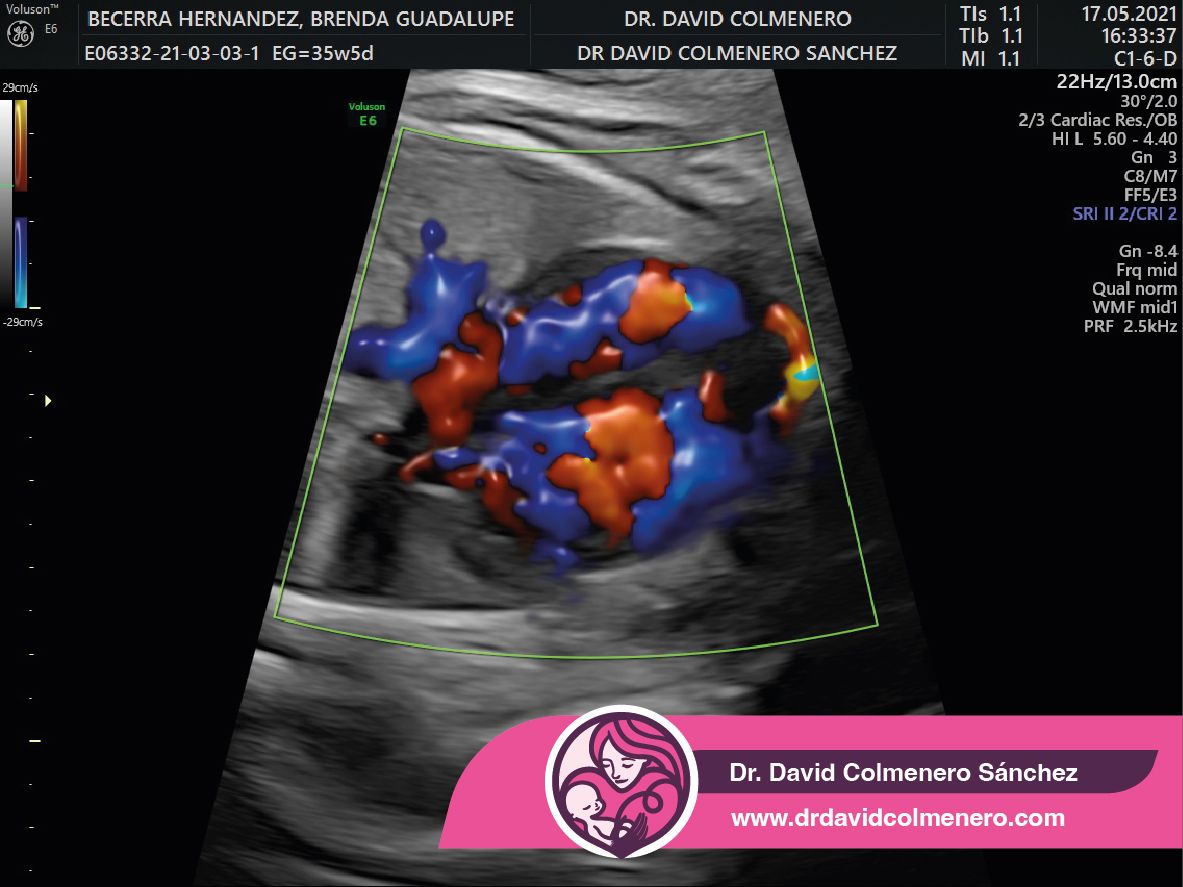 David Colmenero Sánchez-14