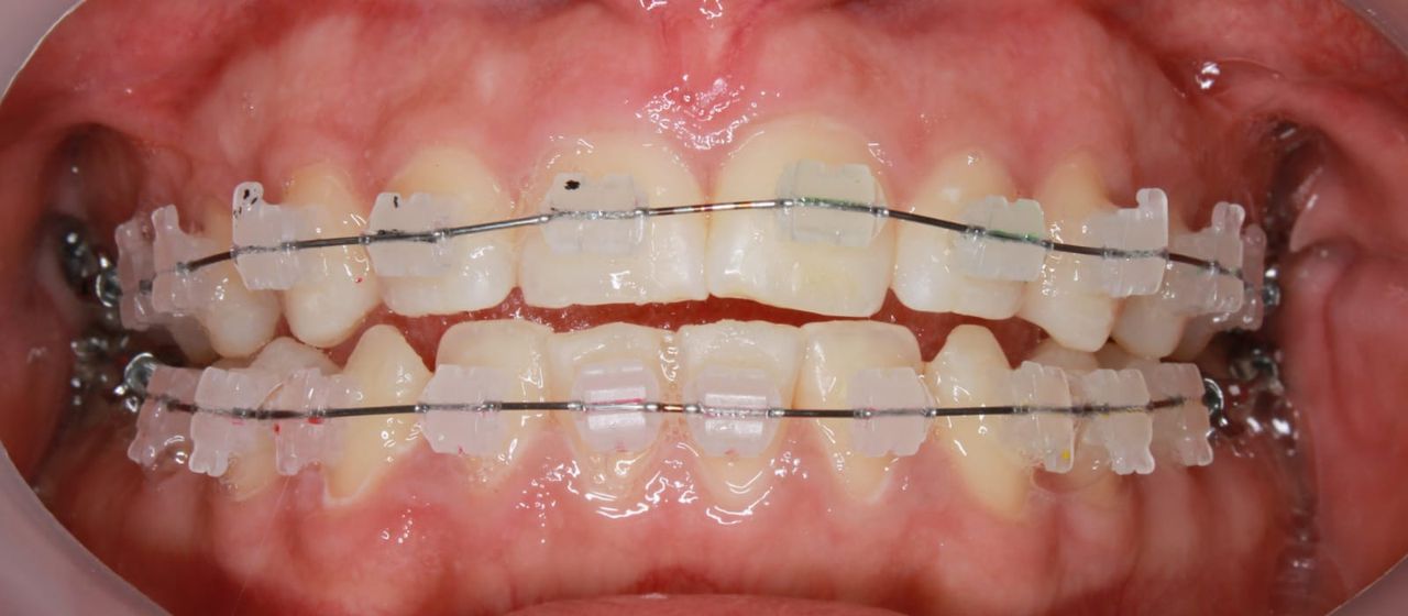 Oliver Oyim Alvarez Ballona-0