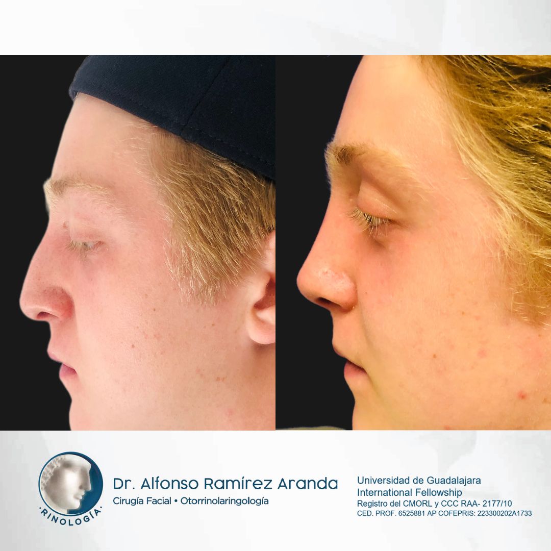 Alfonso Ramírez Aranda-25