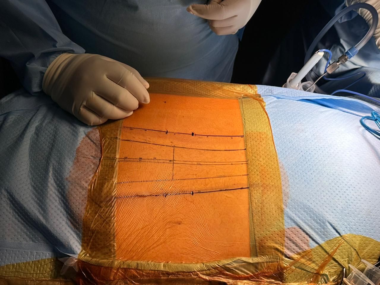 Gerson Reyes Rodríguez-40