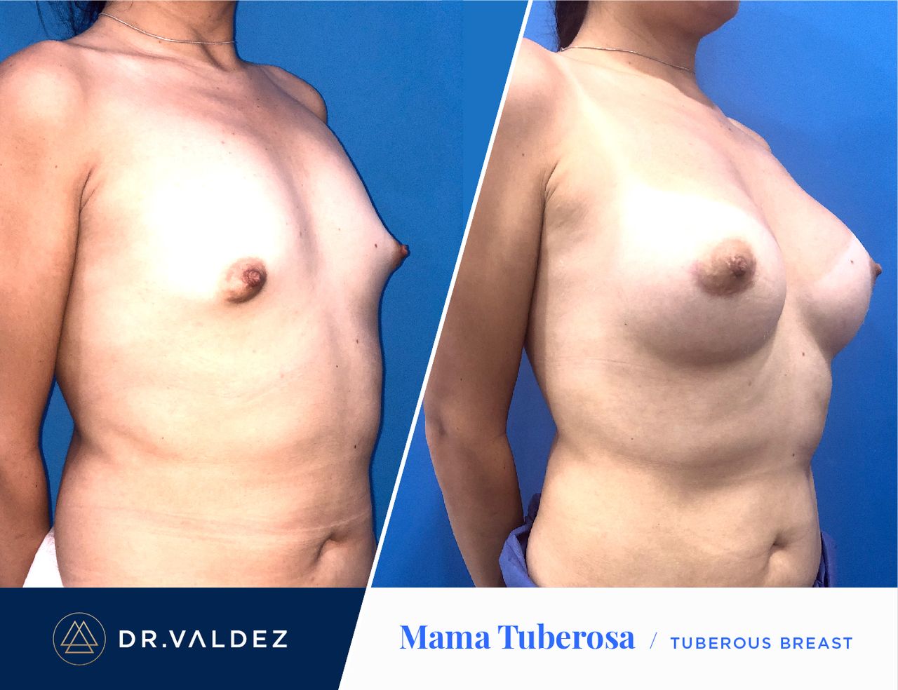 Pedro Arturo Valdez Gomez-25