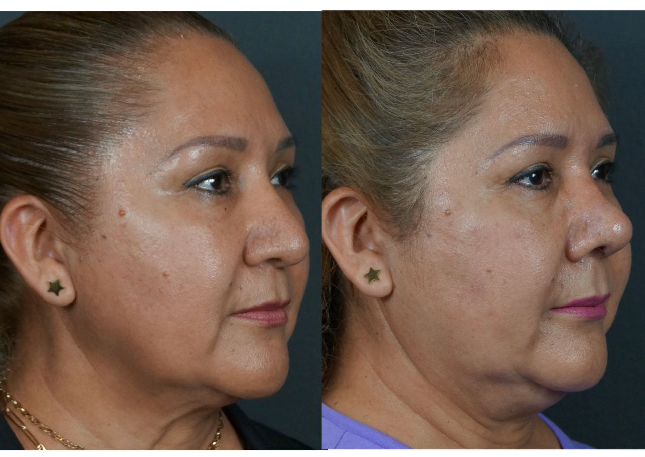 Jose Alberto Alfaro Reynoso-14