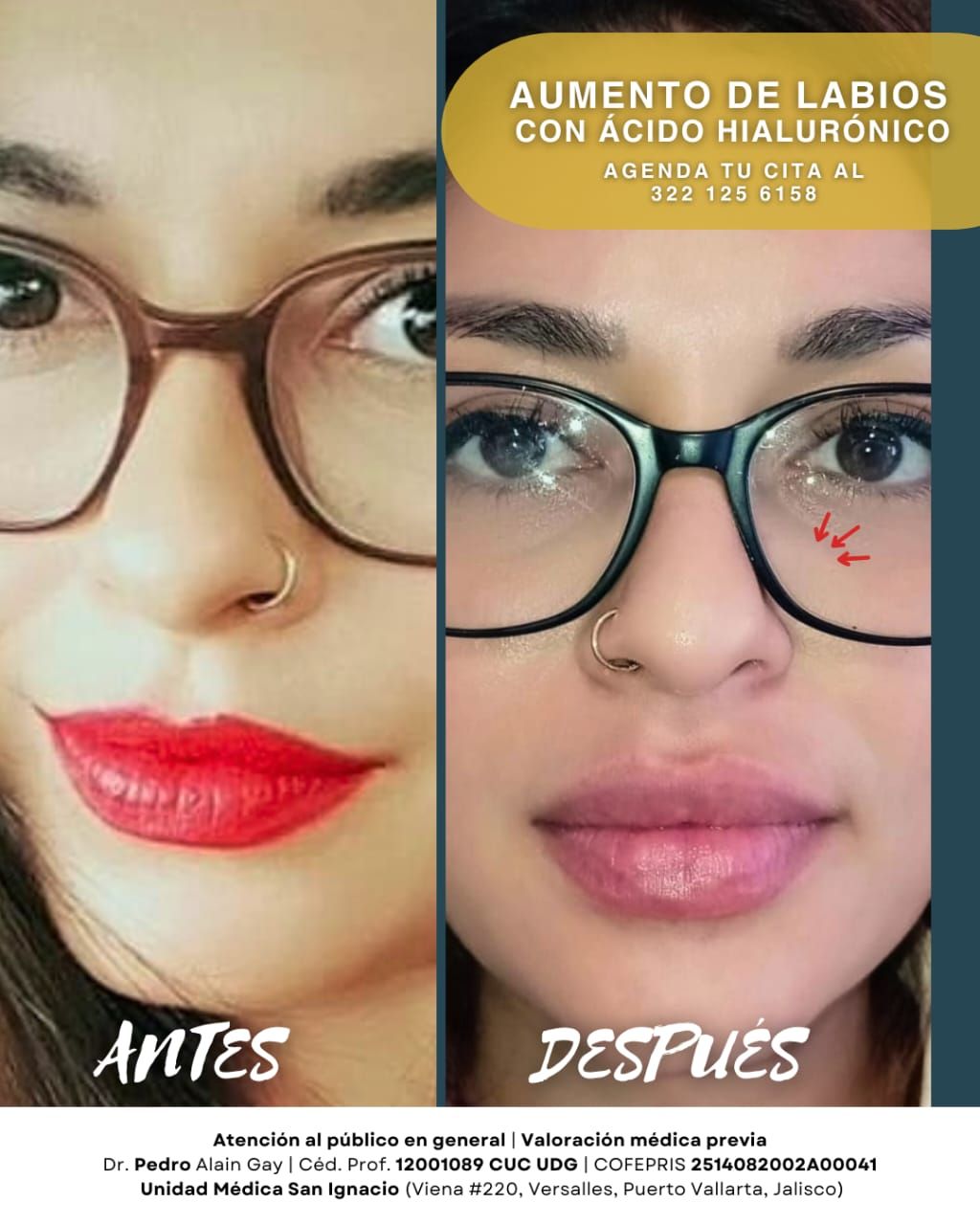 Pedro Alain  Gay Hernández -9