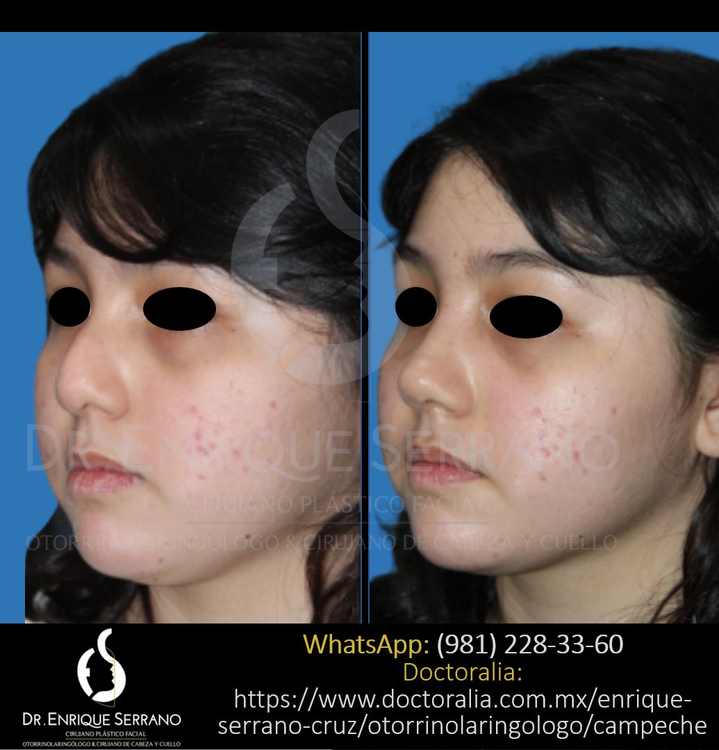 Enrique Serrano Cruz-48