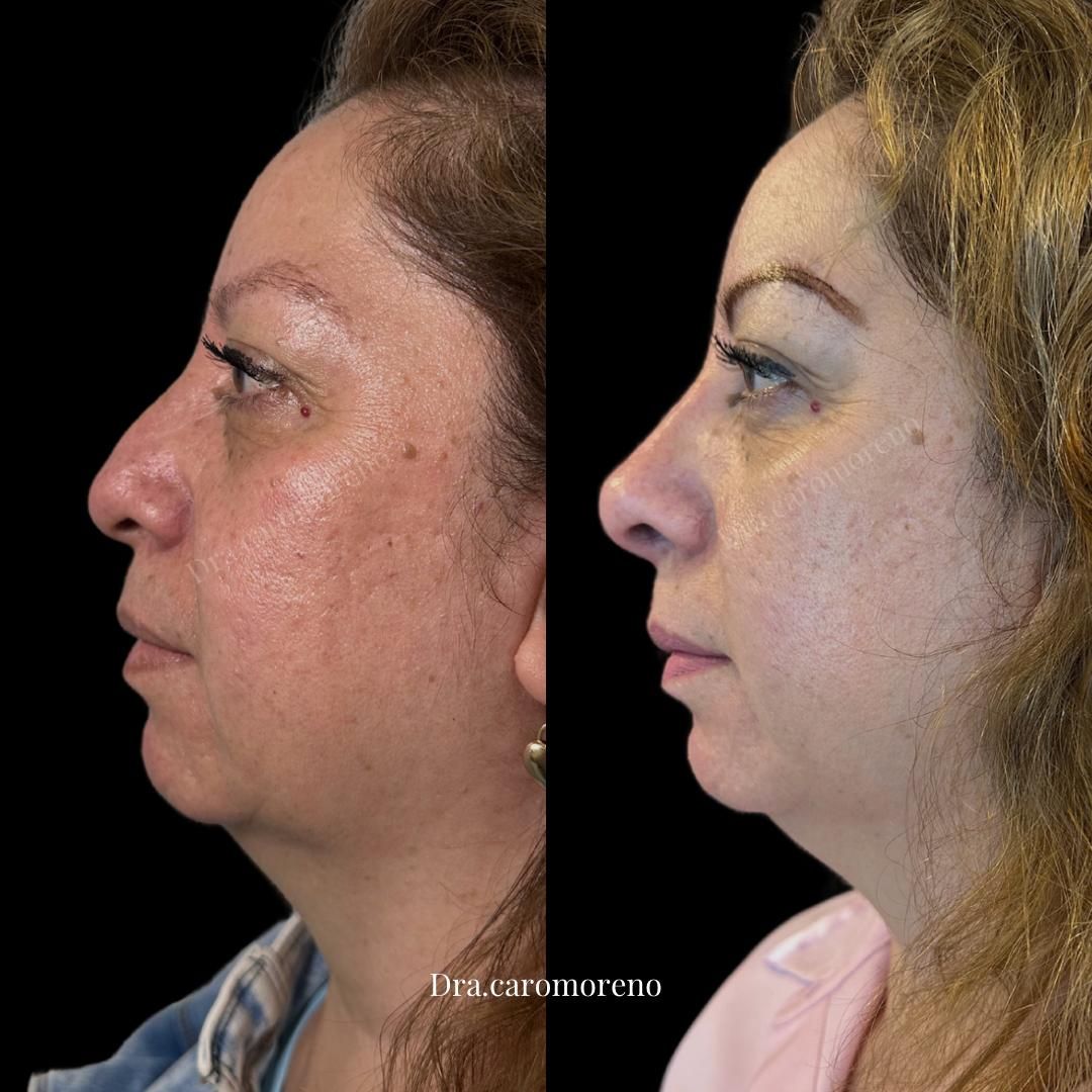 Jazmin Carolina Moreno Galvan-10