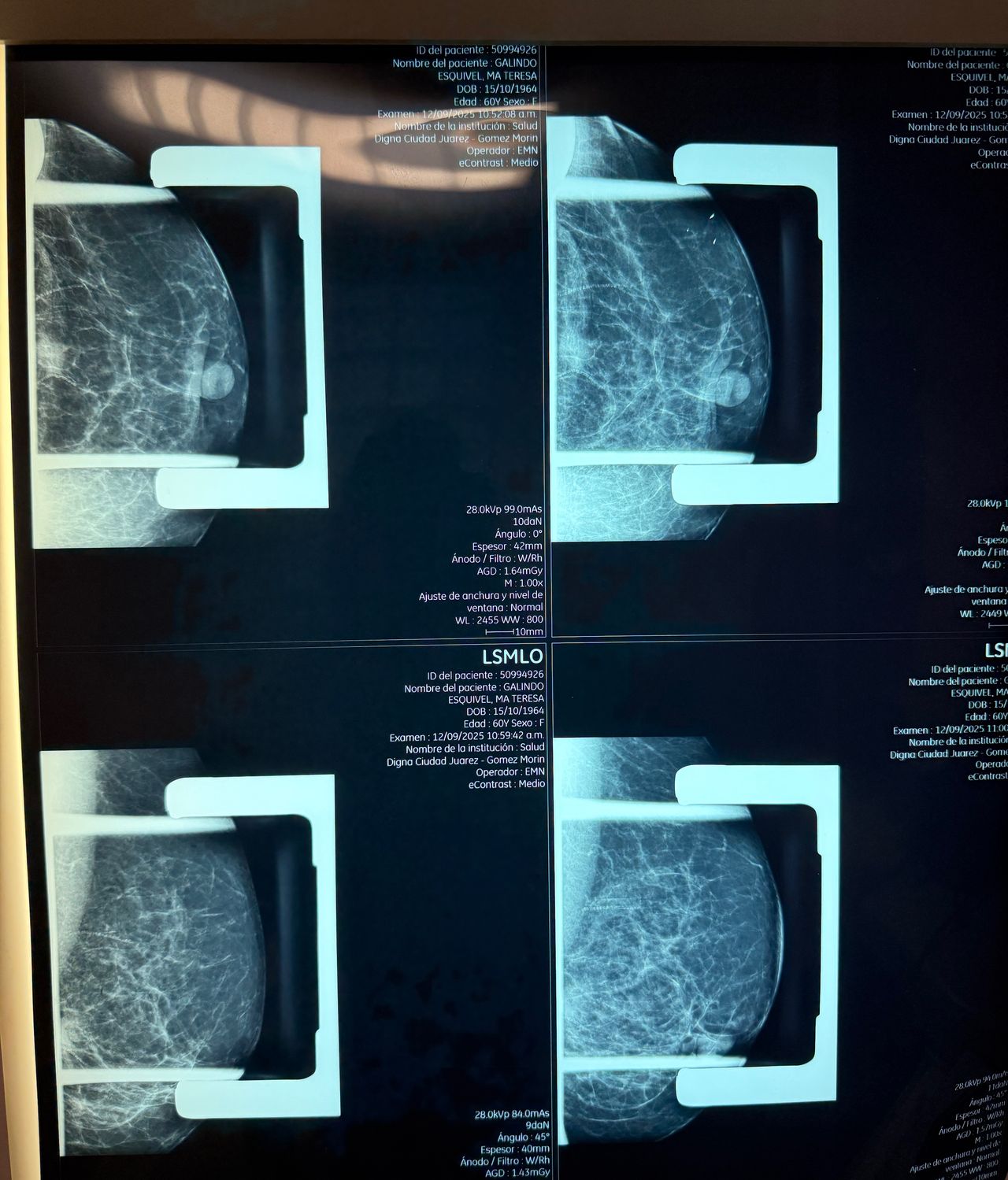 Christian Samuel Uitzil Colli-8