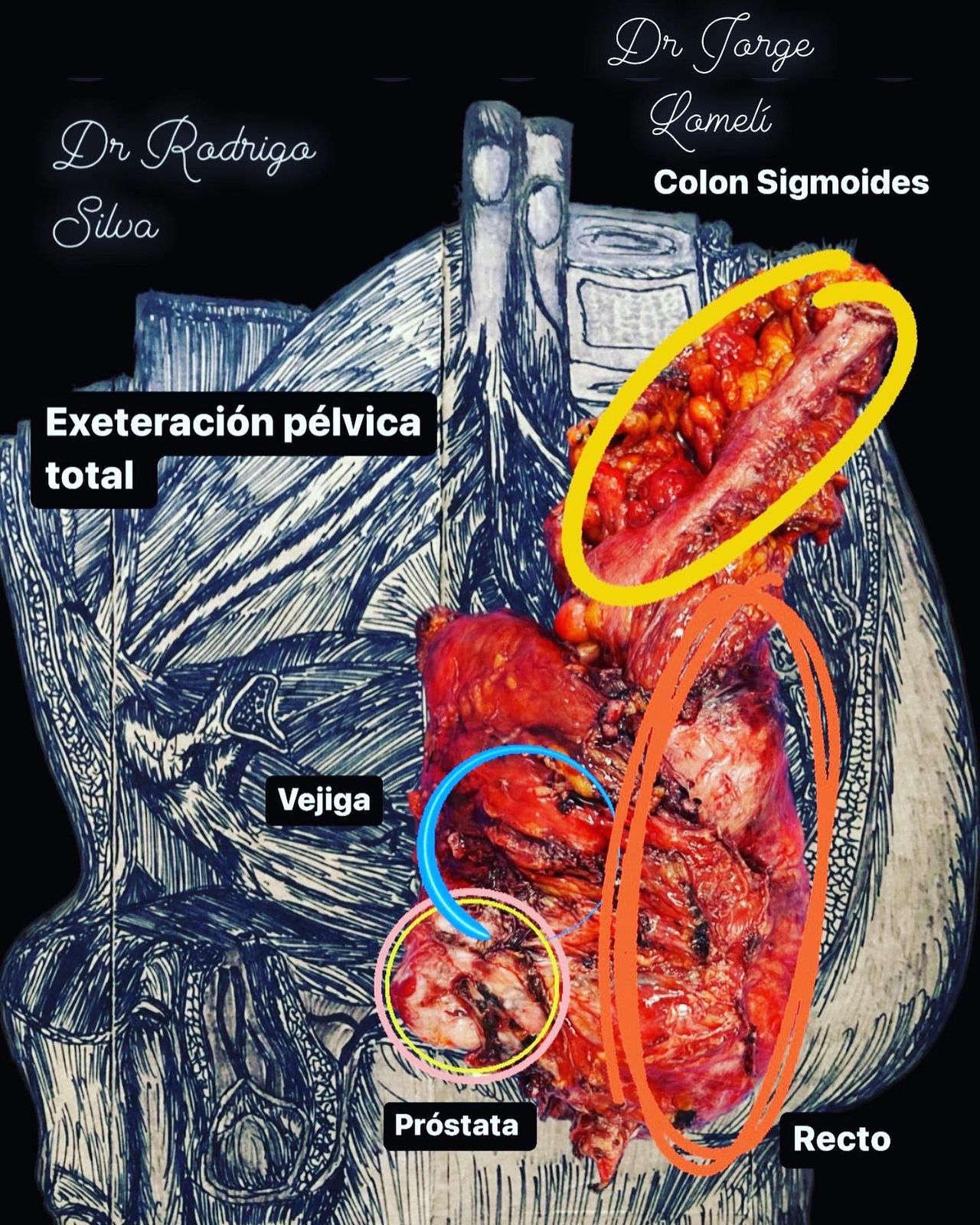 Jorge Antonio Lomeli Muñoz-114
