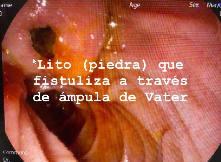 J. César Reyes Vásquez-2