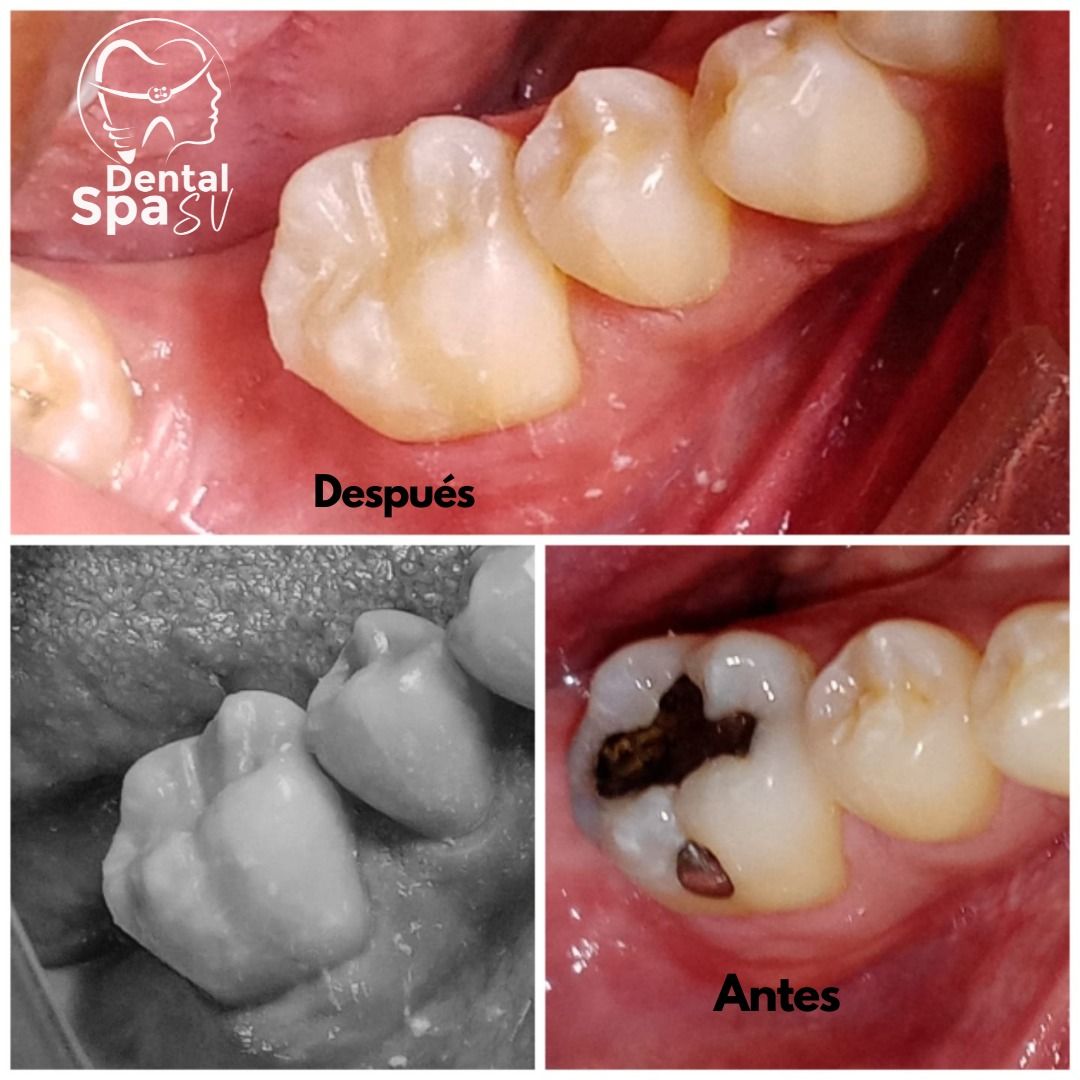 Zury Sarai Moreno Soto-34