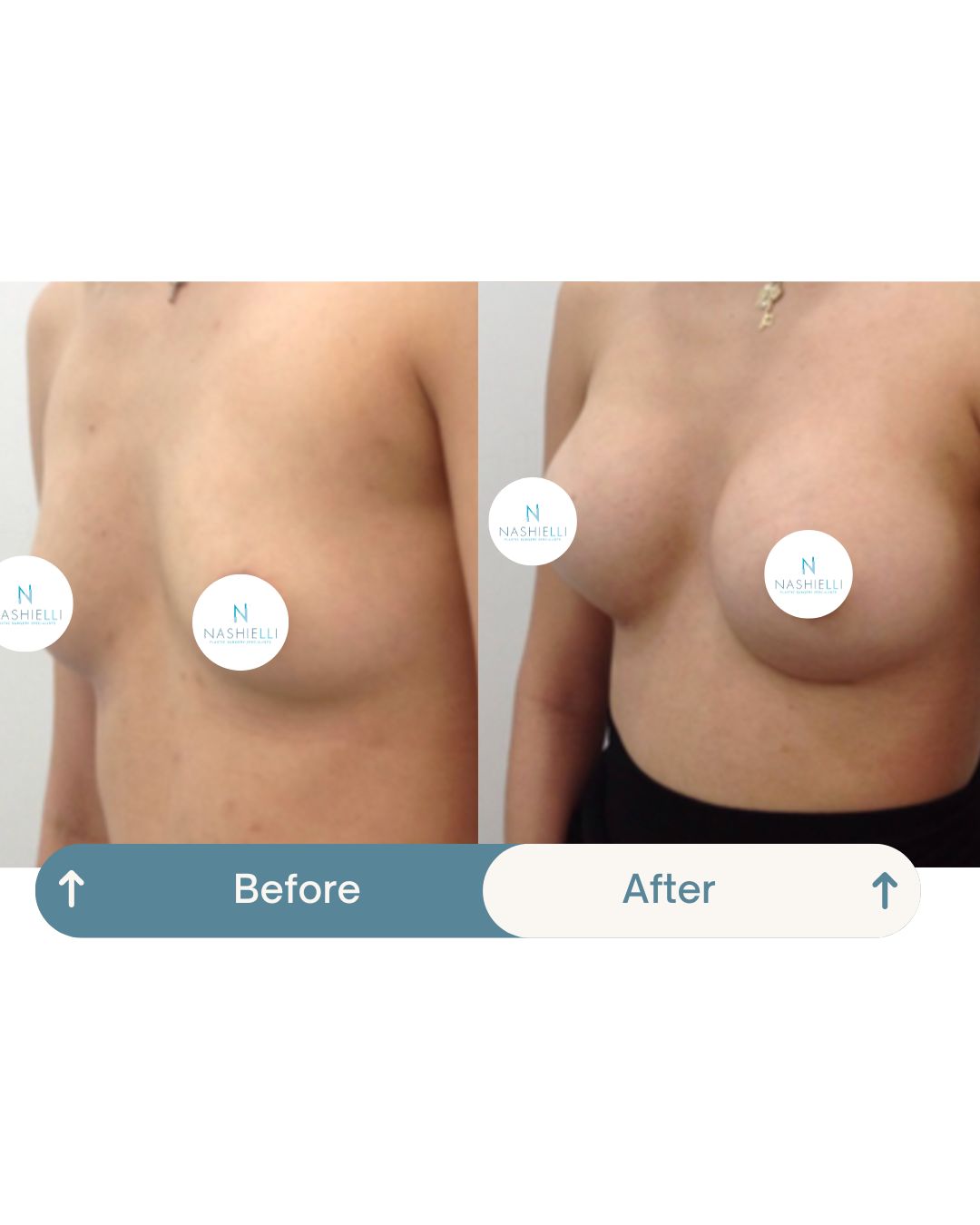 Nashielli Torres Espinosa Chiu-41